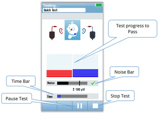 aabr-novus-quick-test-screen