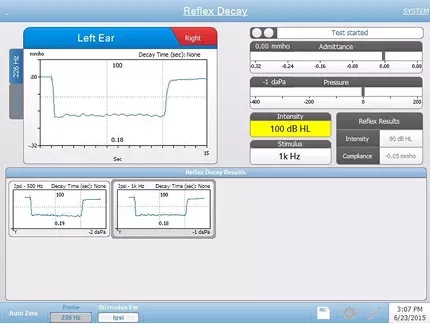 Acoustic Reflex Decay Testing Screen
