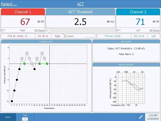 audiostar-pro-act-test-screen-with-data