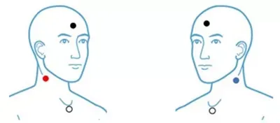 cVEMP Electrode Placement Left and Right