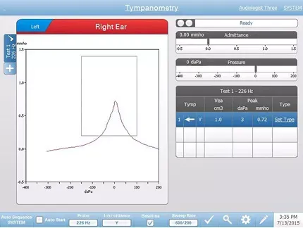 Diagnostic tympanometry testing screen