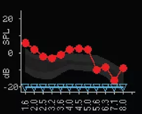 DPOAE Testing Screen