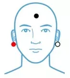 ECochG Right Ear Electrode Placement