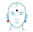 MLR Electrode Placement