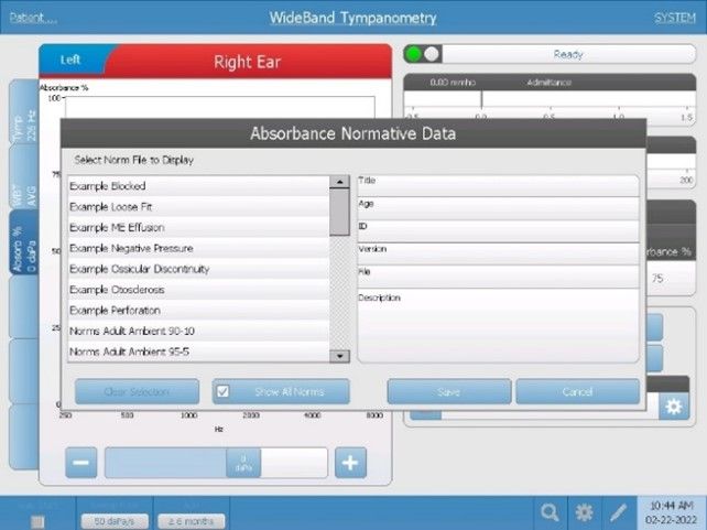 wideband-example-tracings