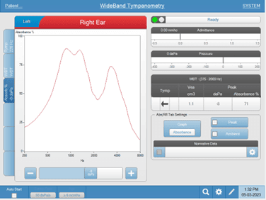 wideband-typical-absorbance-curve